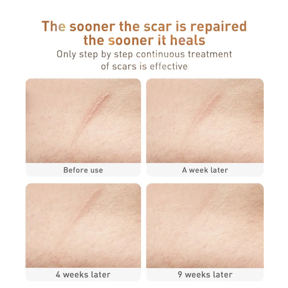 Scar Removal TCM Skin Care Cream