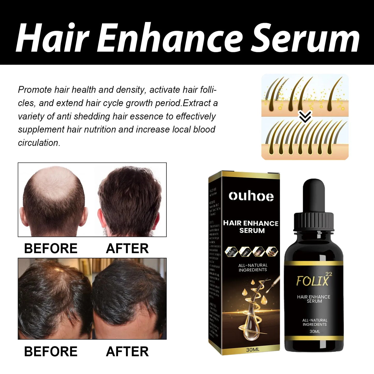 Dense Hair Root Moisturizing Oil