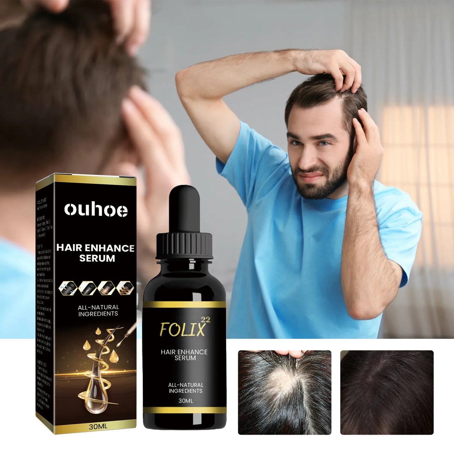 Dense Hair Root Moisturizing Oil
